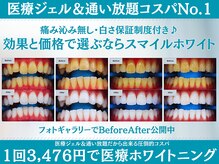 スマイルホワイト 練馬店