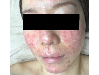 ココティー 金沢駅前店(Cocotii)/グリーンピール　5days