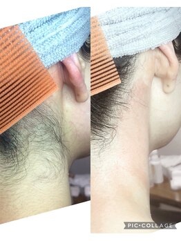 チャーム(CHARM∞)/うなじ