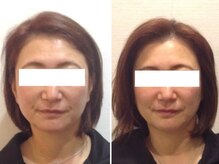 ウェリナ平和堂長久手院/小顔矯正/骨盤矯正/痩身/整体