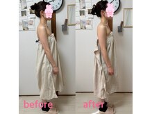 巻き肩猫背の矯正可能♪フェイスラインもスッキリ☆反り腰解消も