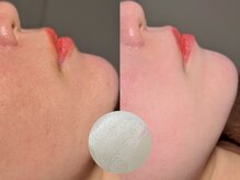 ルーナジェーナ(Luna llena)/池袋/目白/雑司ヶ谷/エステ