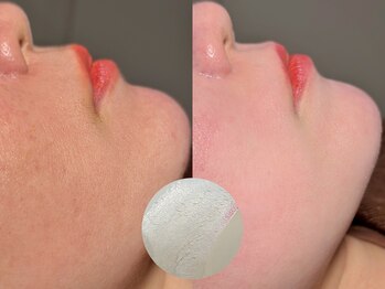 ルーナジェーナ(Luna llena)/池袋/目白/雑司ヶ谷/エステ