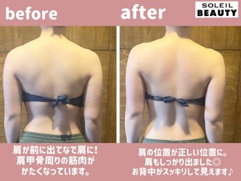 ソレイユビューティー 愛知大学前(SOLEIL BEAUTY)/なで肩解消！！