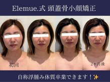 エレミュー 烏丸(Elemue.)/究極の小顔　5回目/10回コース