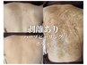 ◇2回目以降【ボディ/剥離ありハーブピーリング】