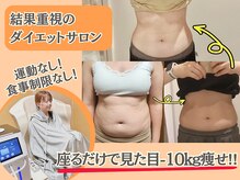 ヨサパーク ハーブ イムア(YOSA PARK imua)