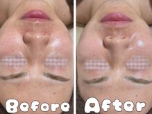 グラシア 倉敷店(Gracia)/お客様の施術事例