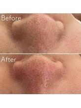 ウェルビーイング(well-being)/毛穴改善専門トリートメント