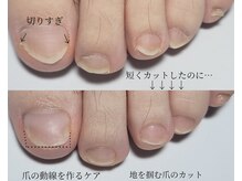 阿良波々岐(アラハバキ)/≪フットケア≫足の身だしなみ！