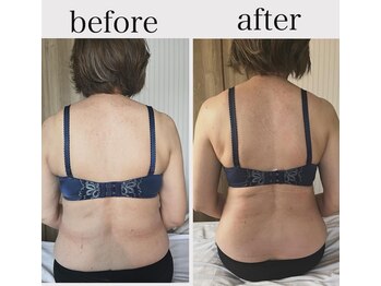 オリス(ORRIS)/ビフォーアフター