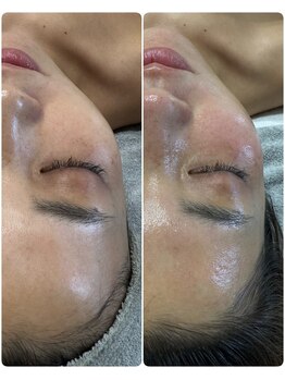 エミニー(Eminy)/プラズマ×ララピール