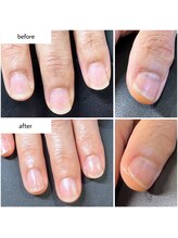 ケアプラス(care plus)/ハンドネイルケア