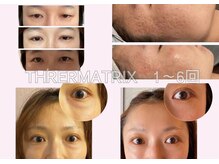 リジュベネーションサロン アリス(Alice)/サーマトリックスB&A