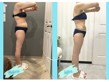 千歳の女神 岡崎店/【施術風景】Before/After