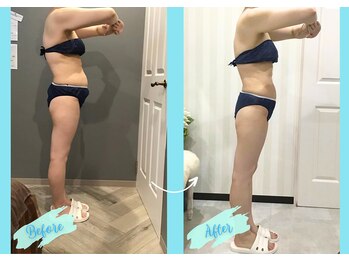 千歳の女神 岡崎店/【施術風景】Before/After