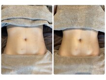 ニコリ(NICOLI)/腸マッサージビフォーアフター