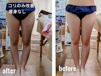 紬(TSUMUGI)/ハリを緩めるだけでしっかり隙間