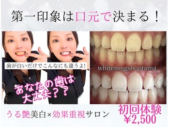 ホワイトニングショップ 多摩店