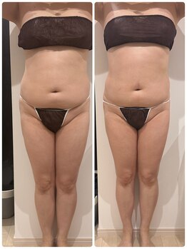 ありひ/セルゼロの効果！！