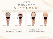 ヨサパーク フェリニタ(YOSA PARK felinita)