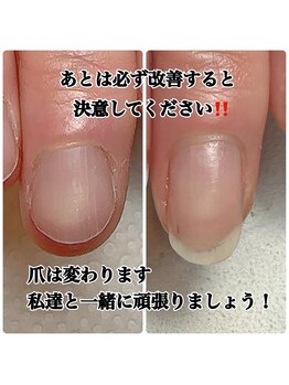 改善する！と決意を固めよう