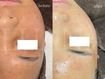 ルアナ(LUANA)/VOSサロンケア