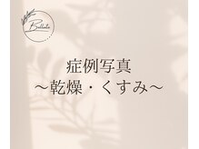 ベルーテ 田町三田(Bellute)/症例写真