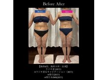 エミニー(EMINY)の雰囲気（最近痩身機器で全身痩せ叶う！）