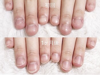 深爪矯正 爪悩み専門店 グラシナ 西宮北口店【4/3 NEW OPEN（予定）】/