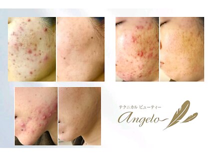 アンジェロの写真