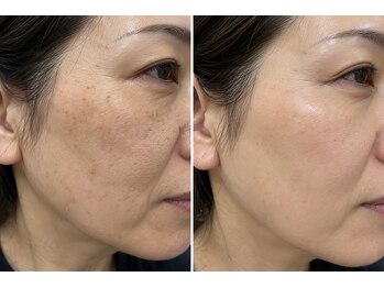 ドクターマジックタッチ(Dr.MAGIC TOUCH)の写真/「こんな肌じゃなかったのに…」増えていく大人の肌悩み。シミ・シワ・くすみ・ハリ不足に、本気の肌管理