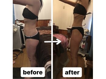 アンリール 旭川店(Anrire)/横側ビフォーアフター