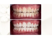 ホワイトニングビューティー 名古屋栄店(WHITENING BEAUTY)の雰囲気（#予約殺到セルフホワイトニング専門店#ホワイトニング BEAUTY）