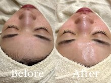 ザ パールズ(The Pearls)/冬の乾燥にはスペシャルケアを☆