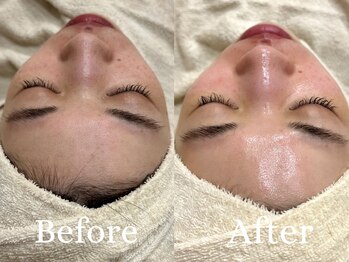 ザ パールズ(The Pearls)/冬の乾燥にはスペシャルケアを☆