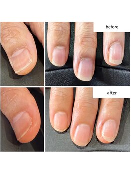 ケアプラス(care plus)/ハンドネイルケア