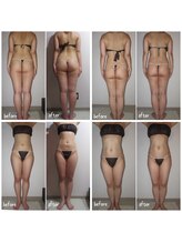 クーラ テュセ(Coeur la Tusais)/全身まるごと7種脂肪撃退★