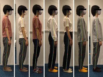 ミライズ整体院 三宮本院/事例【30代女性・姿勢】