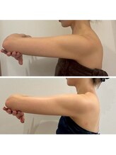 ルナグランデ 心斎橋店(Luna grande.)/厚みがスッキリ