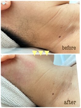 ラ トゥール(La tour)/WAX脱毛