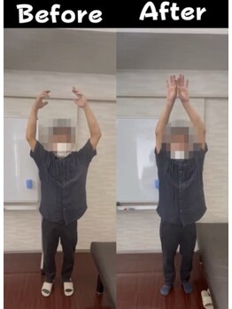 タブチ神経整体院 西宮院/肩の痛み