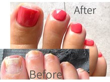 ハドソン スタジオ(HUDSON STUDIO)/【フットケア/麻布十番】　