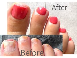 【フットケア/麻布十番】