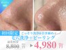 【オープン特価】ゴッソリ毛穴洗浄&全顔ピーリング&90分¥8800→¥4980
