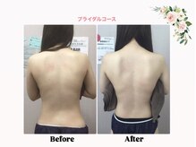 エス(es)/背中～肩甲骨痩せ
