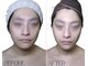 りたの写真