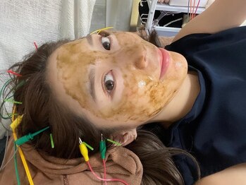 マホロバ(mahoroba)/ハーブピーリング(mahoroba)