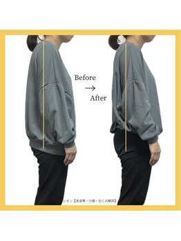 美容整体 レモン/猫背改善