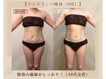 オキシー グレイス 黒崎店(OXY Grace)/インドリンパ痩身